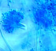 Neuke, J.Th. Schädlingsbekämpfung